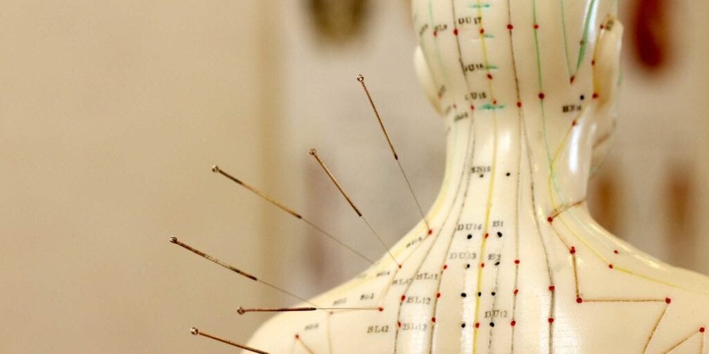 Acupuncture St Helens
