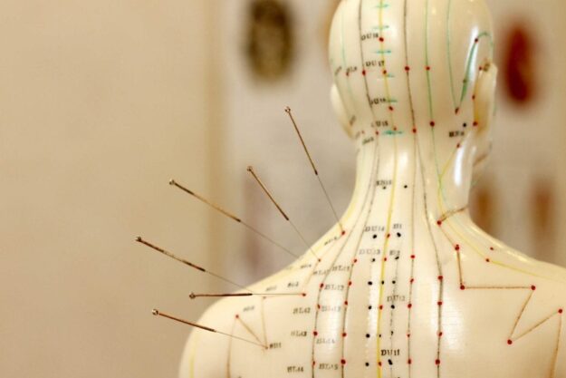 Acupuncture St Helens