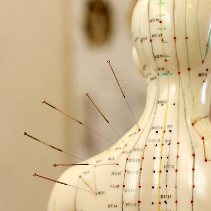 Acupuncture St Helens